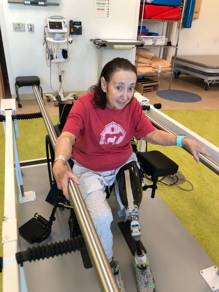 Mom learning to walk again after a below the knee amputation